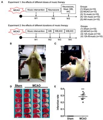 Music Therapy Alleviates Motor Dysfunction in Rats With Focal Cerebral Ischemia–Reperfusion Injury by Regulating BDNF Expression